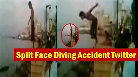 face split accident diving|split face diving accident full video no blur.